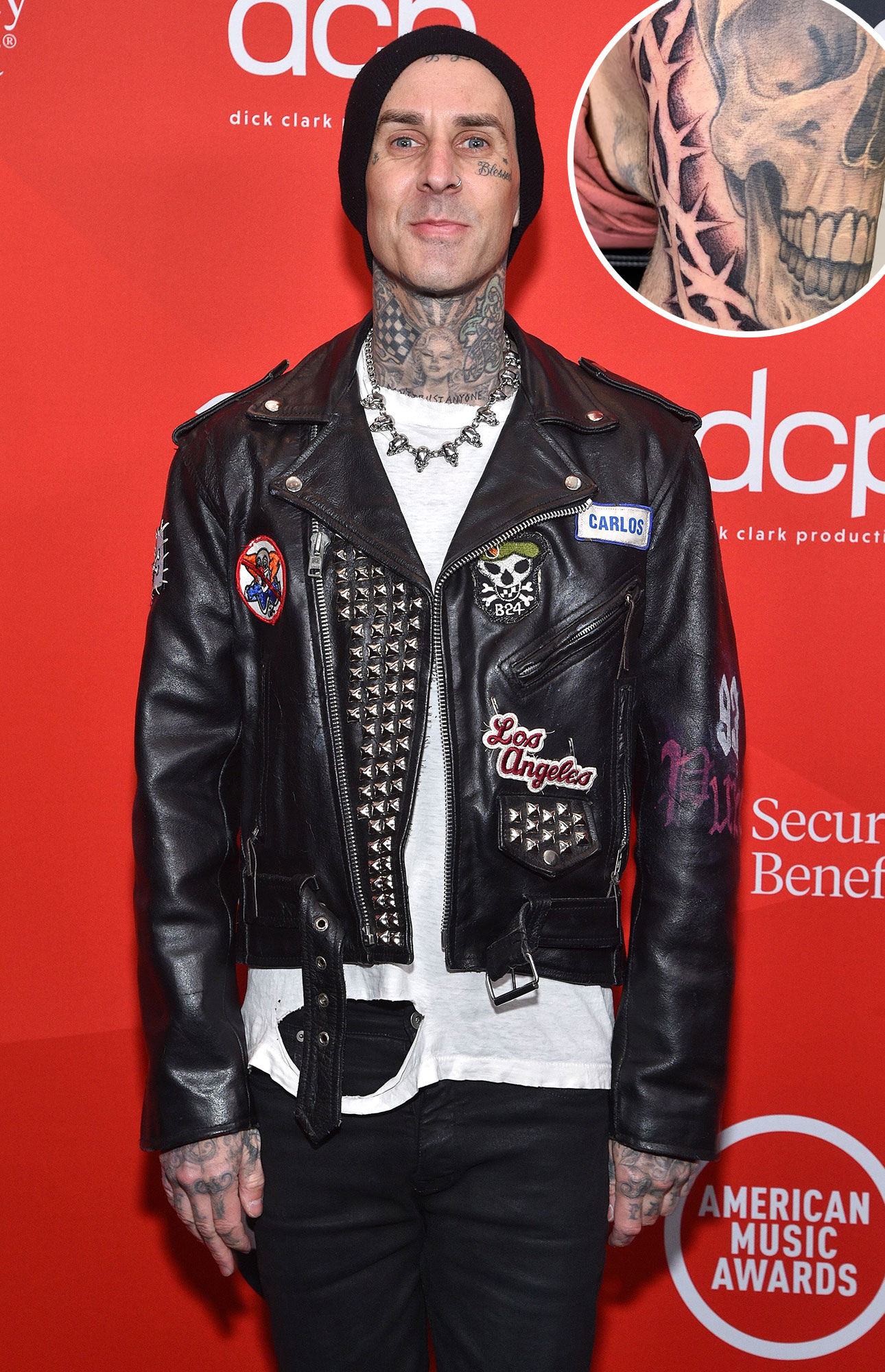 Travis Barker Gets Barbed Wire Tattoo at the Dentist: Pic